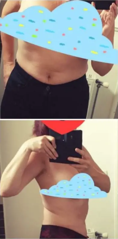 Photo après